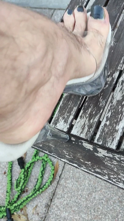 Black toenails