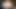 Analschlampe doppelt gefistet und prolapsiert