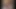 Fetisch-Concept.com - Kurzhaarige Blondine mit Gipsbein -