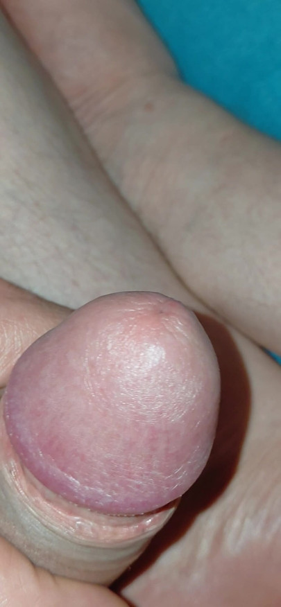 Washing feet with sperm