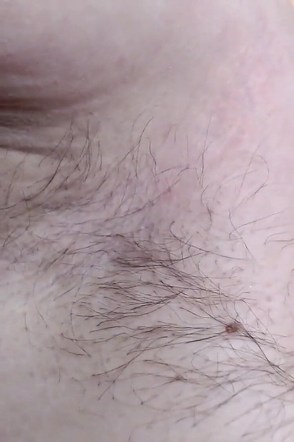 Closeup Fresh Growth Hairy Armpits