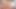 トゥルーアナル - キャンディス・デアがギャップできる