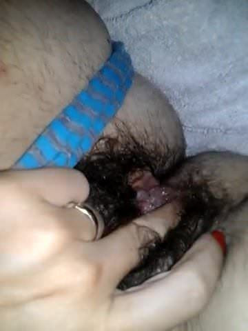 hairy