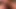 I C U