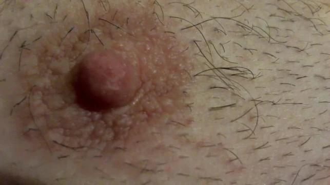 my Nippel