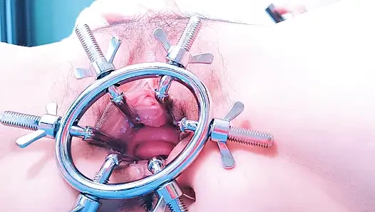 Speculum