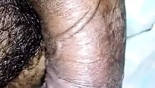 anal