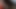 レッドヘッド・ビューティーによる『ラブ・バイツ』