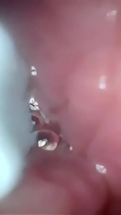 Semen in Cervix Wide Stretching Pussy Endoscope! | Clip 2