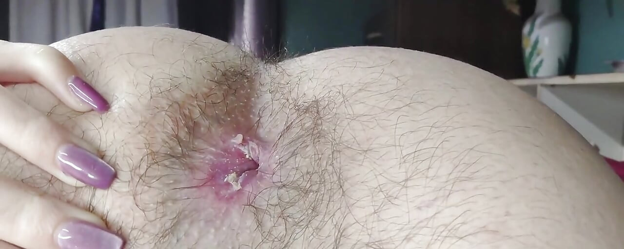An Extreme Close-up of a Super Hairy Butt. I Haven't Cleaned Myself up Very Well, It Seems