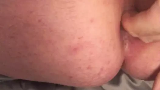 anal 2