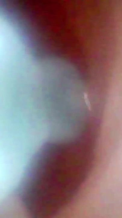 Spectacular moment from "A detailed examination of Lopuza93 Vagina area using an endoscope camera."