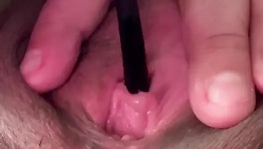 sidik deliği fışkırtıyor