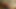 巨大なXXLアナルスプレッダーでのアナルストレッチ