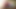 Floppy foreskin video - slow speed