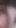 Hemşirenin Özel Tedavisi