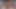 Yeni bekaret cihazından kurtulmaya çalışma bile
