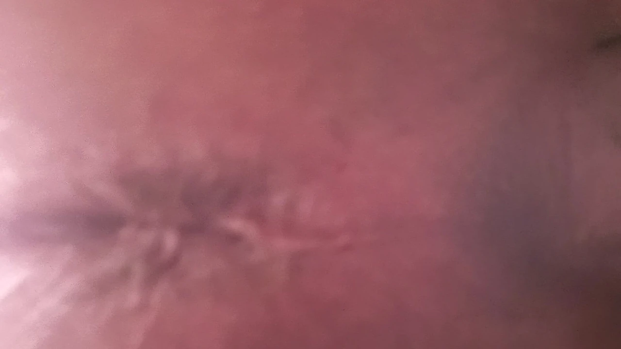 Close up anus