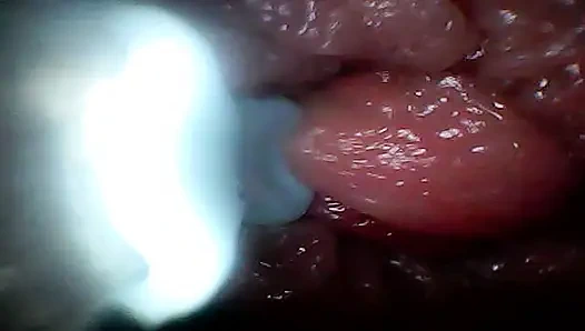 Экстремальная неуядность превращает наблюдателя в активного, голодного участника