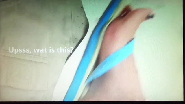 Amputee getting Nurse footjob handjob Trample