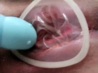 female condom