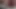 Lizzy Yum VR June 2023 JUST my HOLE #1 post op orgasm pussy masturbation teasing orgasm
