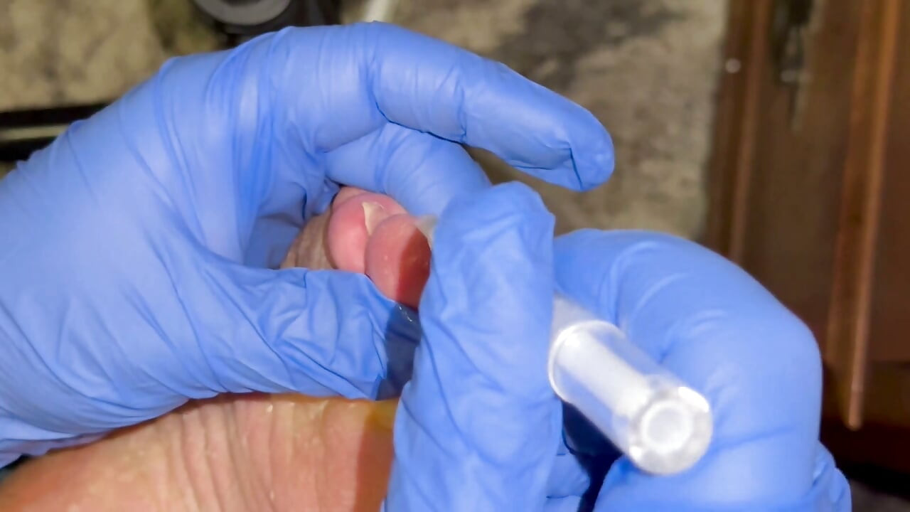 Crusty Foot Care and Worship - FTM