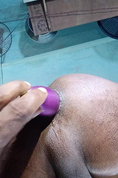 Anal sex