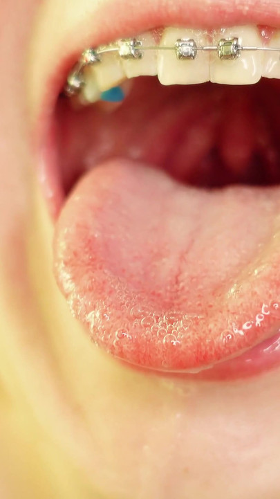 Spectacular moment from "braces mouth tour video - vore fetish"