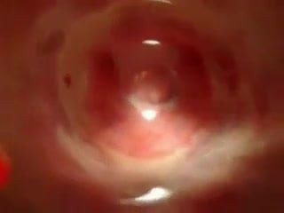 Cup in vagina