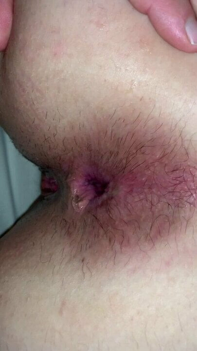 Amateur anal