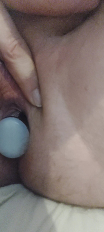 Excitations anal