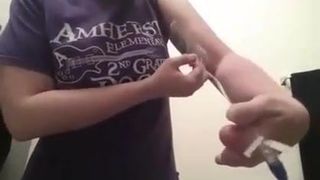 Finger amputiert