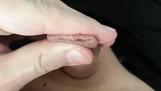 small forskin penis
