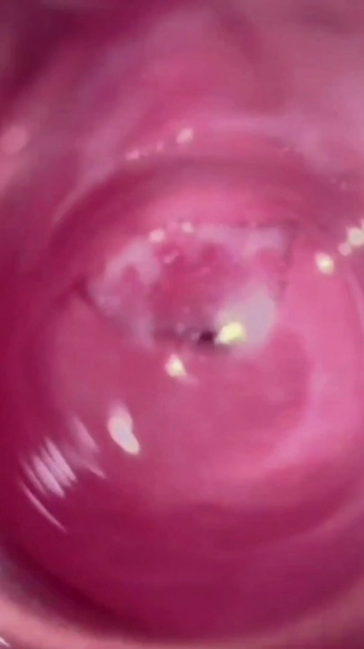 SUPER CLOSE UP - this is what the inside of the vagina looks like | Clip 1