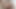 LizzyYum January 2024 ANAL DILATING Post Op Orgasm Pussy anal Masturbation Teasing