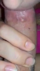 Mejor oral