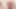 grandma prolapses her big cervix