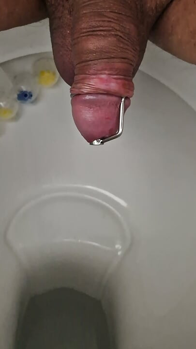 Pag-ihi gamit ang dilator