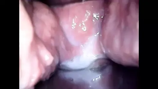 Speculum observation during continuous vaginal creampie