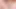 Extreme anal transvestite (psykoanal)