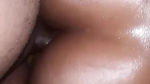 Anal azdırma ve sarkık kemik