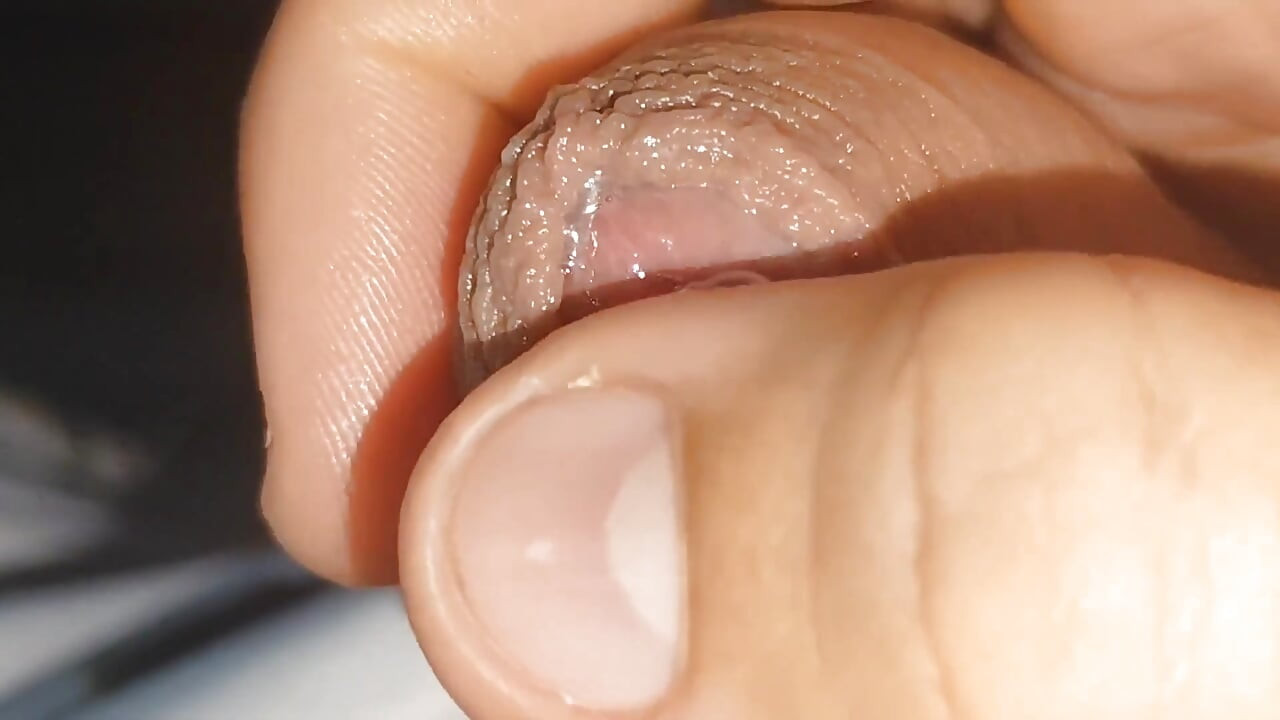 Curious Close-up of Pre-cum in Flaccid Phimosis.