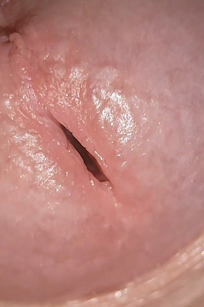 Small Pussy Dick Slowly Blossoming