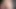 What does a penis look like?