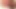 Anal fiş – ilk kez