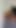 ビキニエリアと肛門用のホットワックスによる女性ワックス脱毛。 | クリップ 2