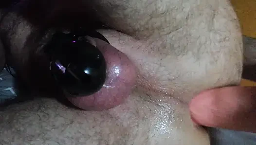 Anal mastürbasyon