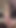 Iconic moment from "GERMAN SCOUT - FIRST ANAL FOR SKINNY TEEN AT REAL CASTING"