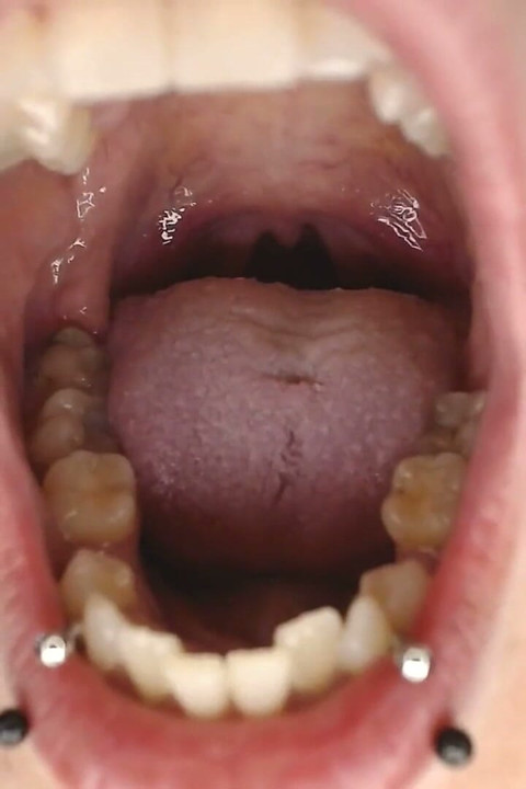 Climb Inside Wide Open Teeth Tongue Mouth Show